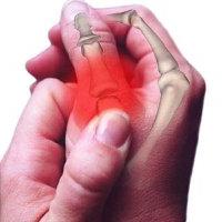 bolesť kĺbov prstov príčiny